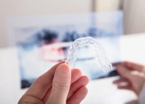 Traitement d’orthodontie invisible